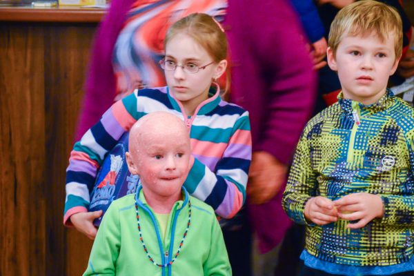 ichtyoza-3-sraz-ichtylku-33